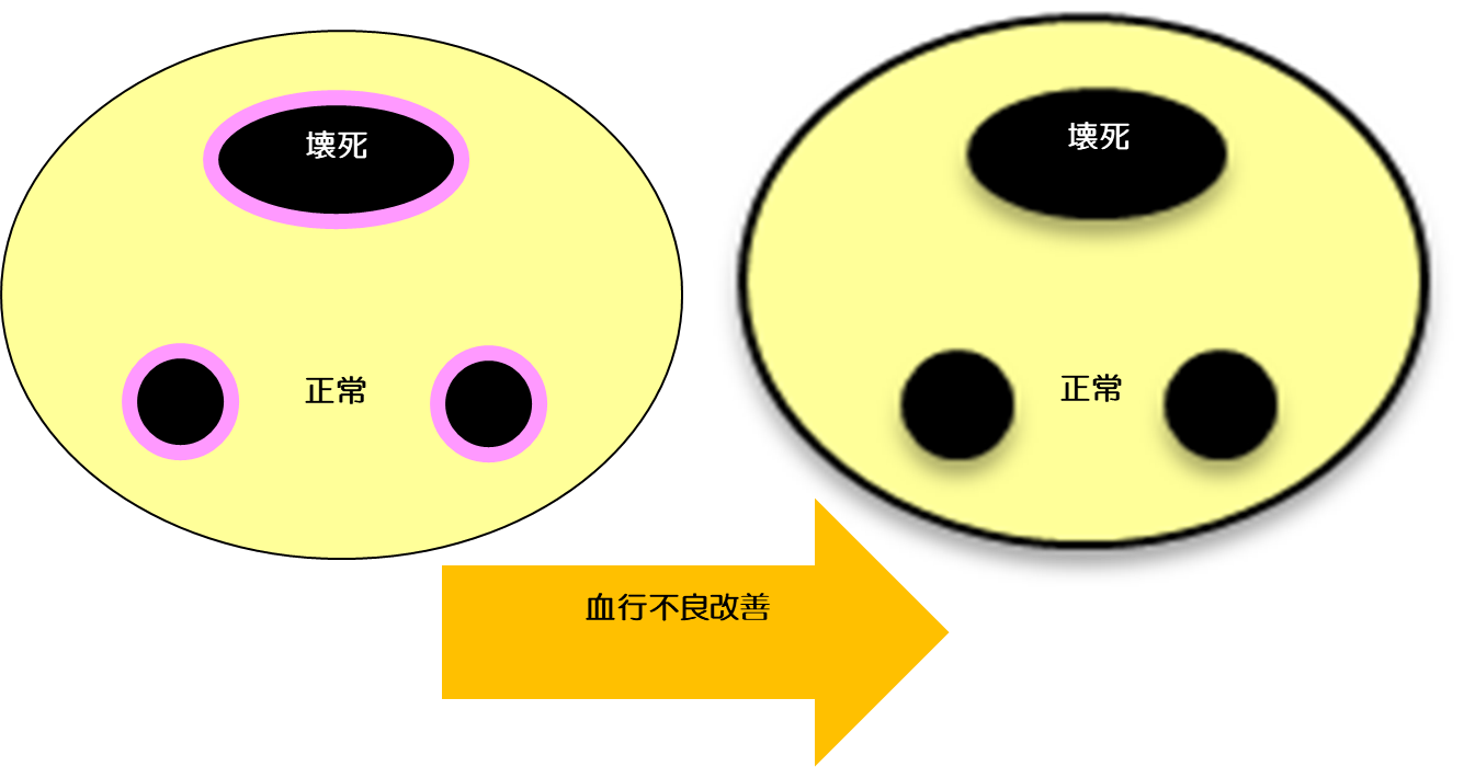 脳の断面図